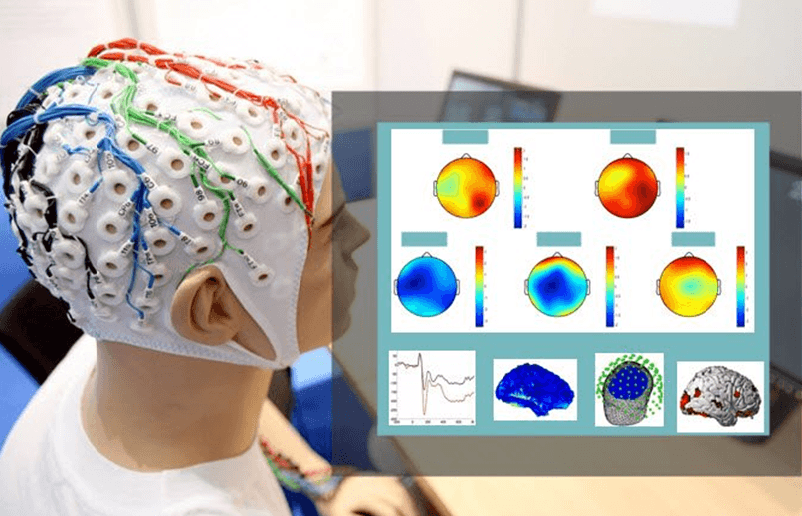 Компьютерная ээг. ЭЭГ Нейро. Топографическое картирование электрической активности мозга. Энцефалография (ЭЭГ). Электроэнцефалография головного мозга (ЭЭГ).